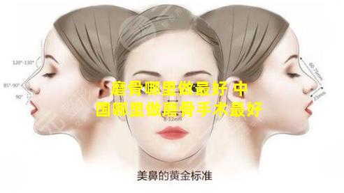 磨骨哪里做最好 中国哪里做磨骨手术最好